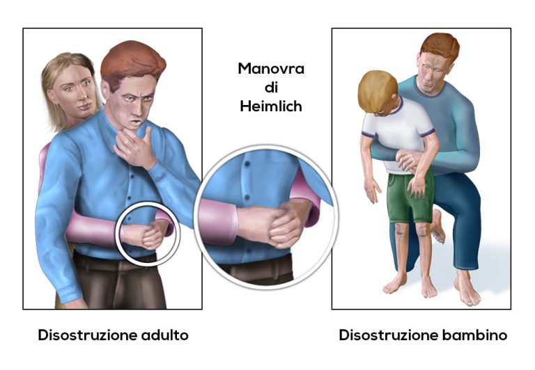 Formazione salvavita per i volontari  Della Protezione Vivile comunale