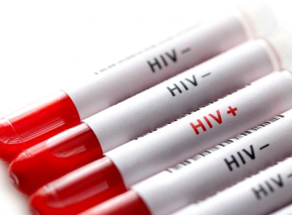 Vaccino italiano contro l’Aids potrebbe in futuro evitare l’assunzione di farmaci a vita