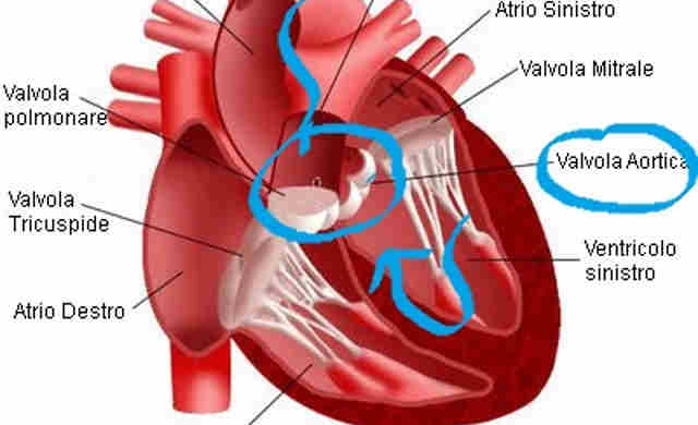 Medicina, non servirà più il bisturi per la sostituzione della valvola aortica