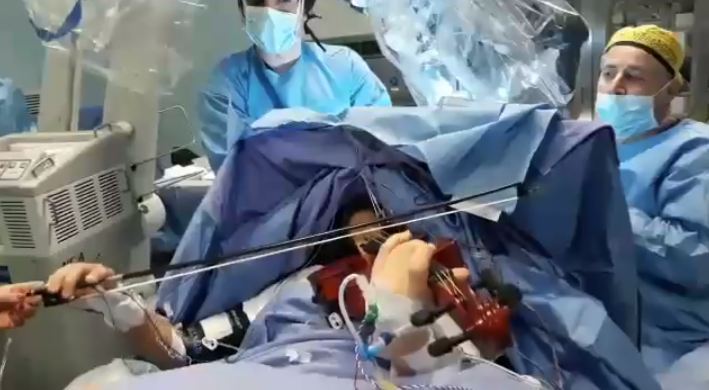 Taranto: straordinario intervento chirurgico al cervello mentre la paziente suona il violino