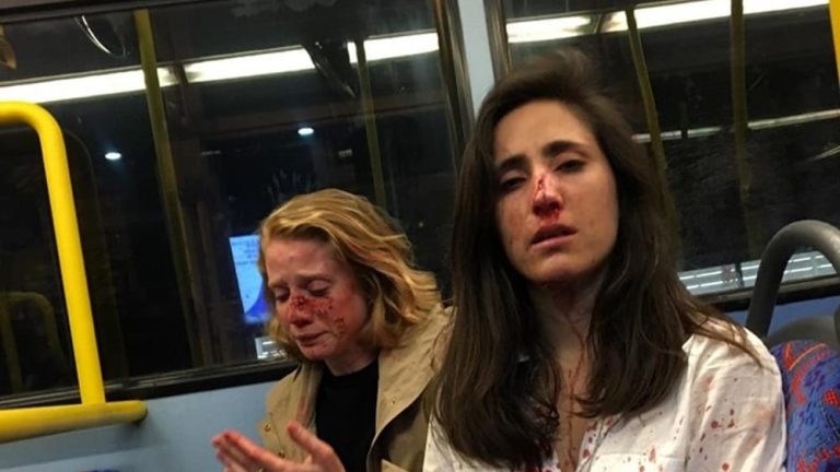 Londra, aggredita e picchiata coppia gay su un bus