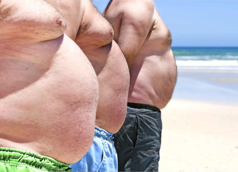 Salute, l’obesità aumenta il rischio di sei volte di ammalarsi di diabete
