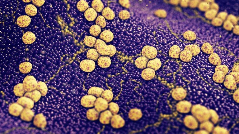 Medicina, prodotto un nuovo antibiotico contro lo stafilococco aureo