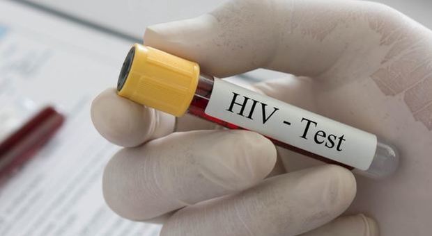 Rimini, contagia l’amante con l’Hiv: arrestato l’untore