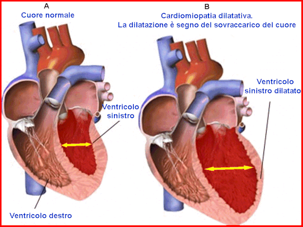 Salute, in forte calo in Italia le patologie del cuore (-54 per cento)
