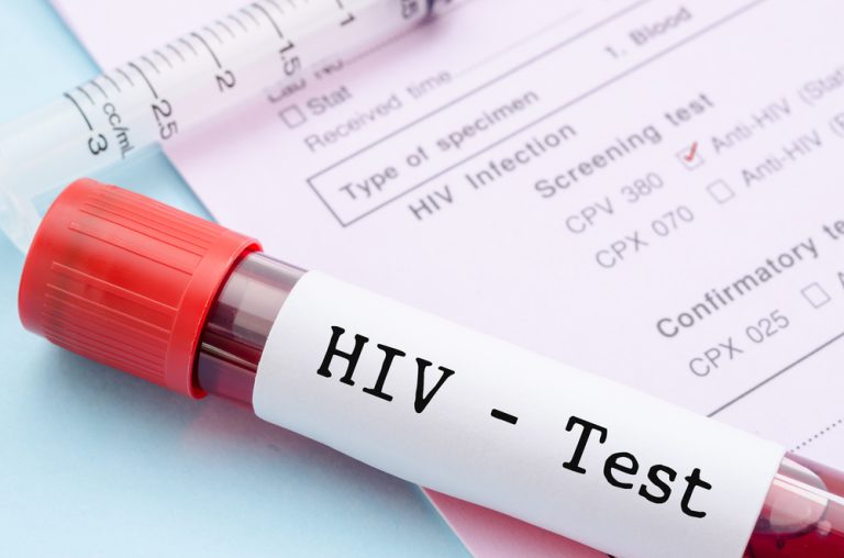 Salute, giornata mondiale contro l’Aids: test gratuiti nelle città italiane