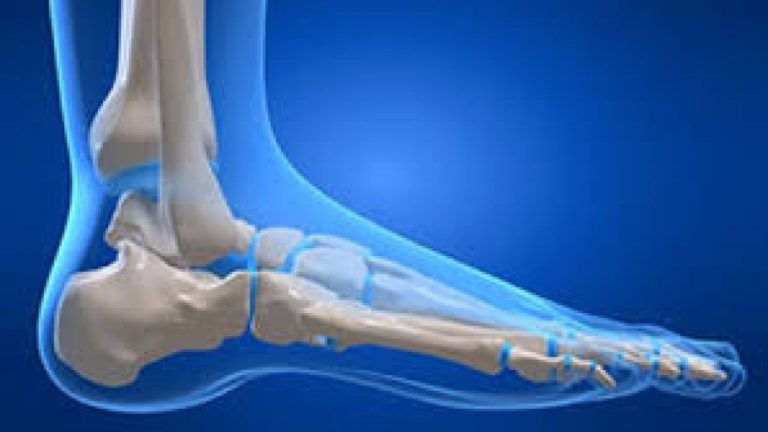 Bologna, ricostruita per la prima volta al mondo una caviglia in 3d all’istituto ortopedico Rizzoli