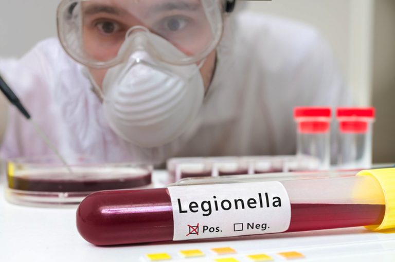 Legionella, altri due casi sul nostro territorio