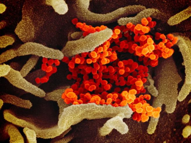 Coronavirus, dagli Usa la prima foto a colori in alta risoluzione del Covid-19