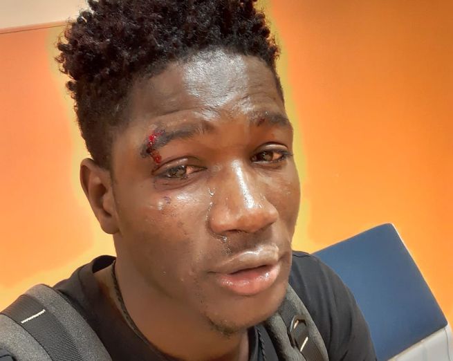 Palermo, un ragazzo originario del Senegal aggredito e picchiato da un gruppo di adolescenti