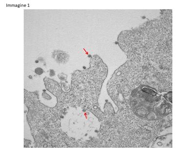 Emergenza coronavirus, ecco le prime immagini del “Covid-19 lombardo”