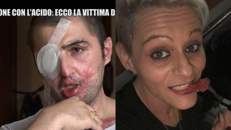 Busto Arsizio (Varese), sfregiò con l’acido l’ex fidanzato: condannata a sette anni e dieci mesi Sara Del Mastro