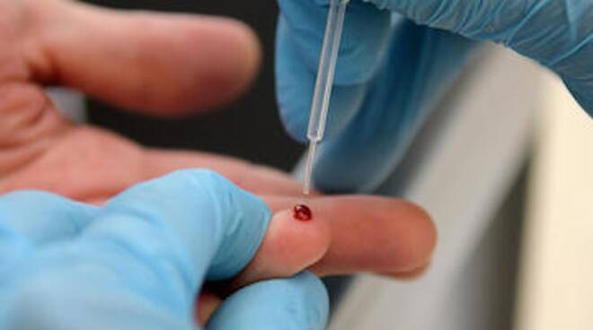 Coronavirus, in Lombardia effettuati 80mila test sierologici, di cui oltre 66mila già processati