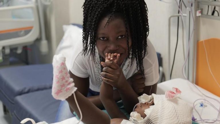 Roma, straordinario intervento chirurgico durato 18 ore al Bambin Gesù: separate due gemelli siamesi di 2 anni