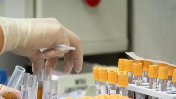 Coronavirus, proseguono i test per il vaccino in Gran Bretagna e in Cina