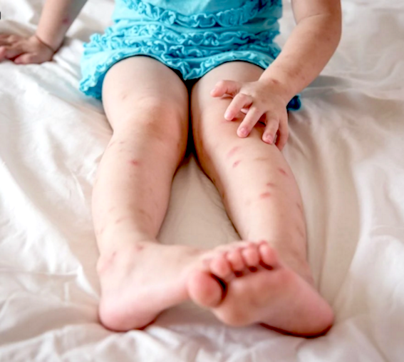 Mother & Baby lancia la campagna anti zanzara con i prodotti naturali