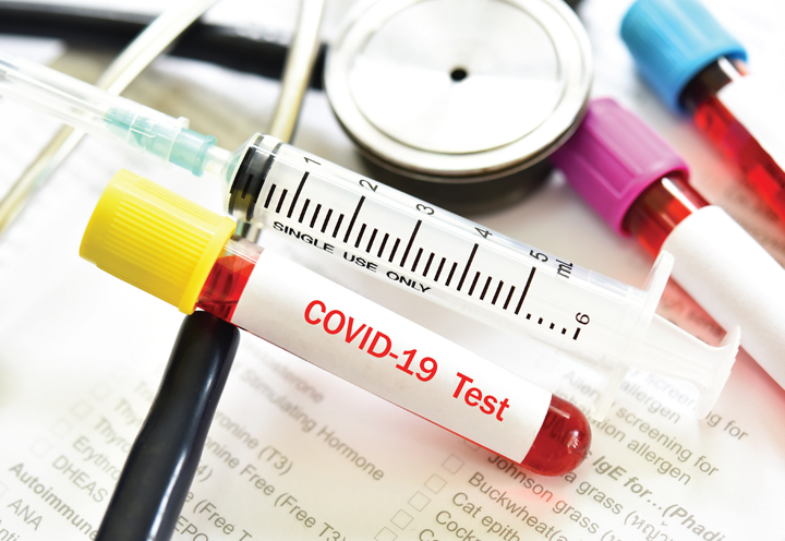 Coronavirus, sono nove i vaccini contro il Covid entrati nelle fase 2 e 3 della sperimentazione clinica