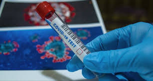 Coronavirus, a Roma test alle barriere autostradali Nord ed Est per chi viene dall’Europa orientale