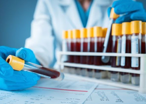 Annuncio del ministro Speranza: Test sierologici anche nelle farmacie