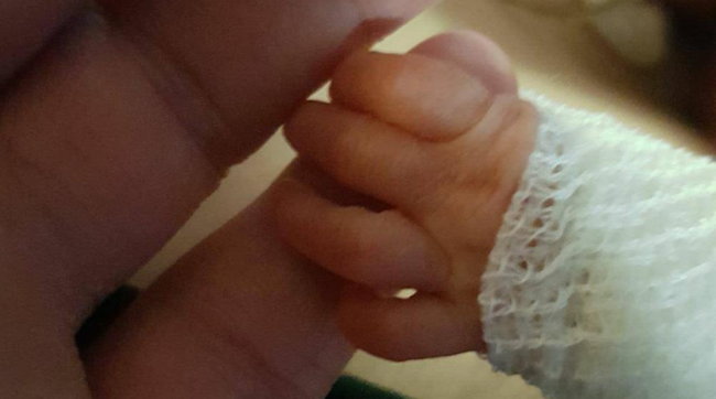 “Miracolo a Milano”: salvato al Policlinico un neonato prematuro dal peso di soli 370 grammi