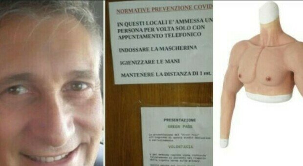 Ecco chi è l’odontoiatra che si è presentato a Biella con un braccio al silicone. L’Ordine dei Medici: “Chiederemo un provvedimento disciplinare”