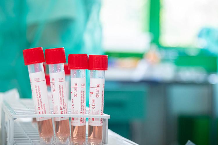 Covid, le Regioni chiedono di escludere dai contagi gli asintomatici