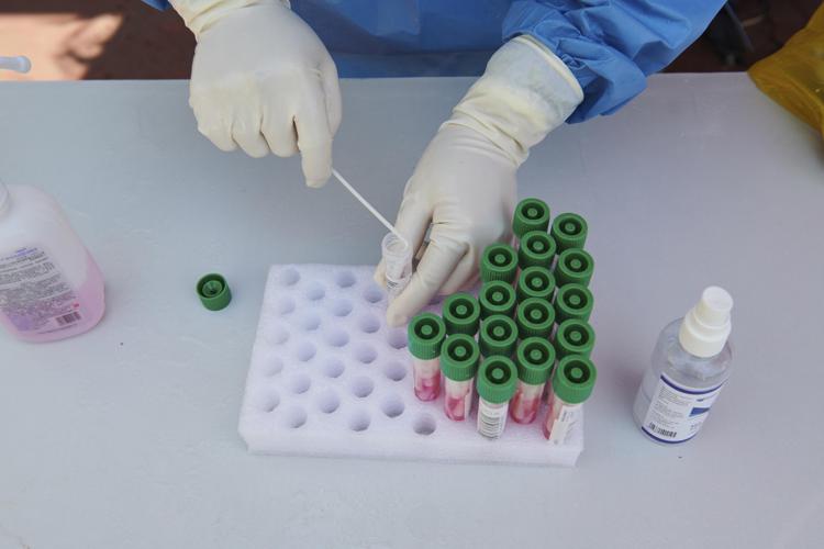 Covid, secondo l’Oms Italia è quarta nel mondo oggi per nuovi contagi. Quinta per il numero di morti