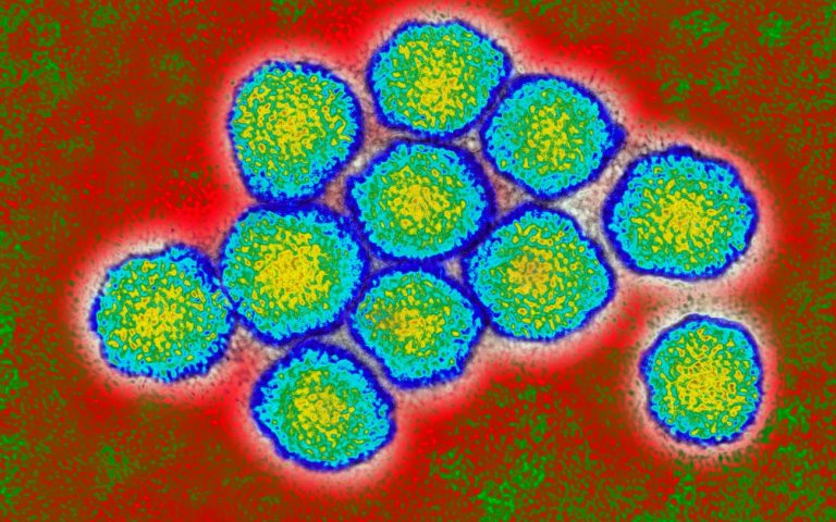 Nuovi casi di epatite acuta sono stati riscontrati in alcuni bambini in Spagna, Paesi Bassi, Irlanda e Danimarca