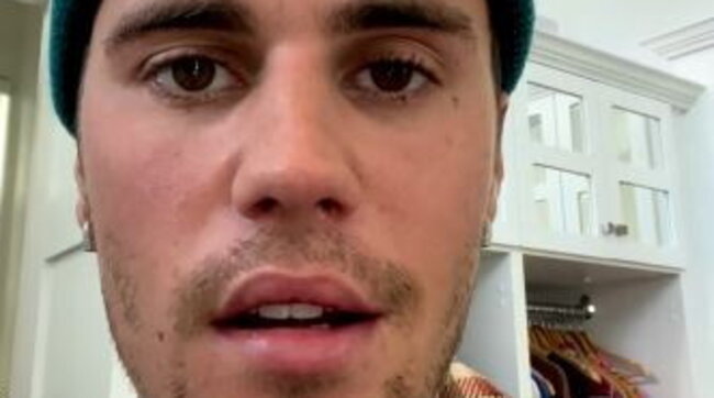Musica, parla il cantante Justin Bieber: “Ho una paralisi al volto ecco perché ho fermato il tour”