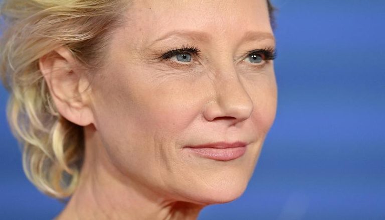 Usa, l’attrice Anne Heche è in gravi condizioni dopo un pauroso incidente stradale a Los Angeles