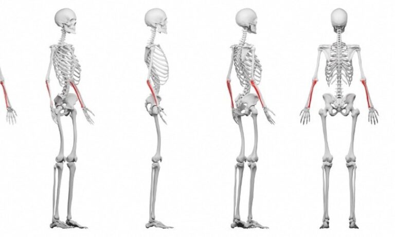 Una donna over 50 su 3 è a rischio frattura ossea