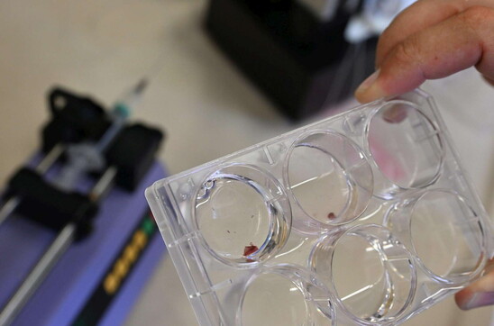 Carne coltivata, Mattarella firma ddl ma governo attende verifica Ue